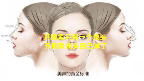 开眼角只有一个线头 开眼角线头自己掉了